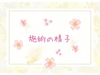 サクラ(sacra)/ご来店から施術の流れ