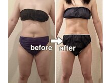 チェルシーロイヤルエステティックサロン(CHELSEA)/パーソナルダイエットエステ