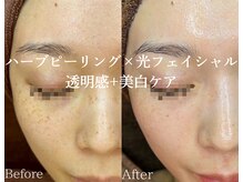 インディビューティー 六本木店(inde beauty)の雰囲気（毛穴・ニキビ・シミ・くすみ改善♪透明肌+理想の素肌へ◎）