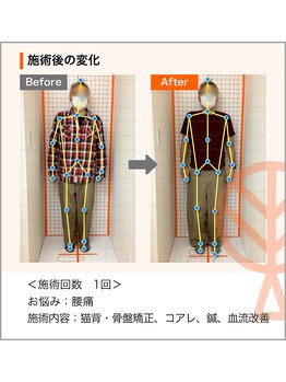 ただき接骨院 整体院 新前橋院/お悩み：腰痛