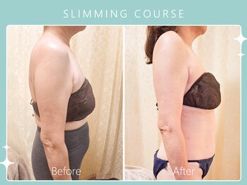 ハノハノ 八代店(HANO HANO)/選べる12種の痩身脂肪撃退☆