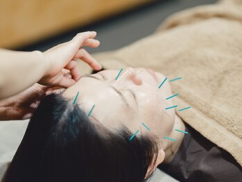 ファミリア鍼灸院 高田馬場(Familia鍼灸院)/美容鍼が初めての人も大歓迎！