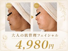 レゾン 京橋店の雰囲気（《ビフォーアフター》40代以上のスタッフが担当。大人の肌管理♪）