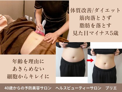 ブリエの写真