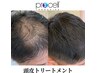 自分の力で生やす!ごまかさない育毛促進技術!プロセルセラピーズ