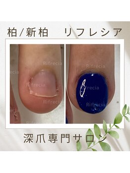 リフレシア(Rifrecia)/長さ出ししてお好みカラーを