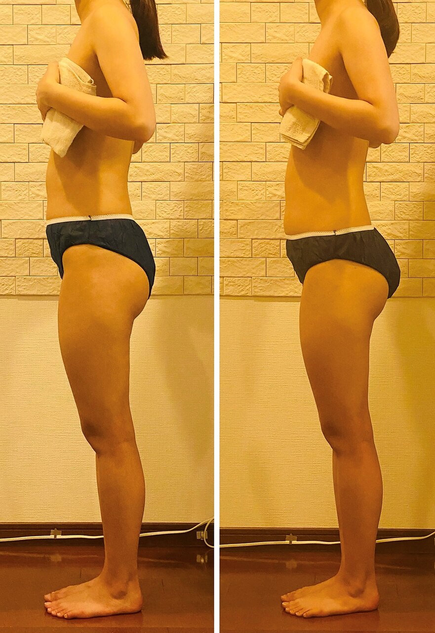 フォト｜うつくし痩身 美サロン ゼットワン(Z-ONE)｜ホットペッパー