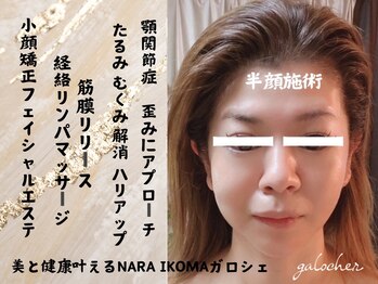 ガロシェ(galocher)/小顔　半顔体験