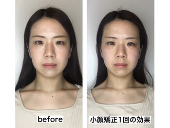 ビジュー(bijoux)/一度のビフォアフ１