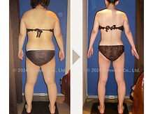 【9か月間の結果】体重▲20.3kg 体脂肪▲17.1%　ウエスト▲18.4cm