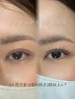 ニコ(Nico)/まつ毛パーマ/ラッシュリフト