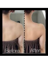 ラグラン銀座メディカルエステ 高輪ゲートウェイ店/【圧倒的人気】一撃級僧帽筋除去