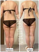 プラウディア(PROUDIA)/むくみ／下半身/太足/太もも