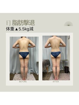 FJ/脂肪撃退コース