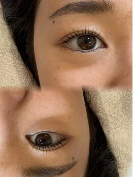 アレーズ(Al'aise)/◇施術イメージ◇