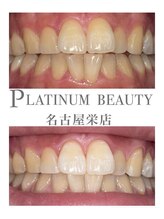 プラチナムビューティー 名古屋栄本店(PLATINUM BEAUTY)/お客様Before After