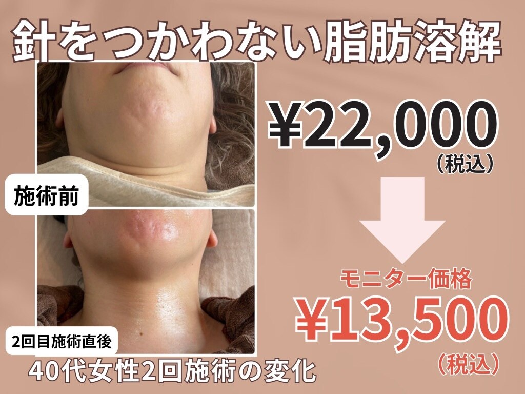 ページミュー｜ホットペッパービューティー