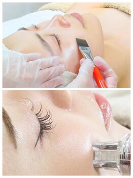 天空のゆりかご 八王子店の写真/【新メニュー導入！】LIPO VELA-V脂肪分解★強力美肌フェイスライン40分￥9,900！無理なく理想的な小顔に◎