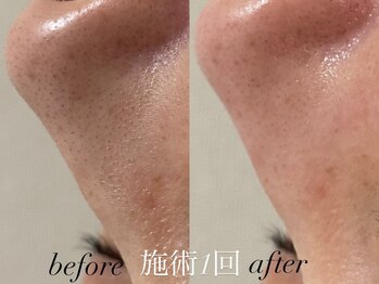 リスポアラボ(LIS PORE.LAB)/