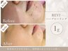 【9月末まで限定★】お試し!!REVIハーブピーリング1g¥5,500