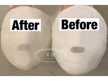 美極 トータルビューティー(美極 TOTAL BEAUTY)/恵比寿/小顔コルギ/エステ/