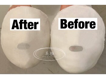 美極 トータルビューティー(美極 TOTAL BEAUTY)/恵比寿/小顔コルギ/エステ/