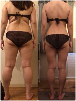 ビューティーワークス シャンティ 印西店(Beauty Works Shanti)/お客様ビフォーアフター(2)