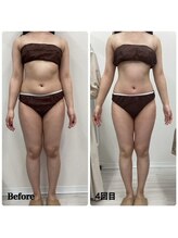 ルピア(L'pur)/全身痩身★