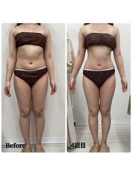 ルピア(L'pur)/全身痩身★