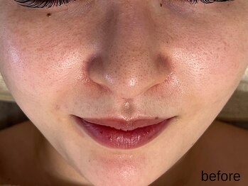 サロン ド エメ(salon de aimer)/【Before】本格エイジングケアに