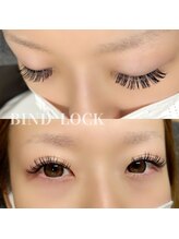 アネラ(ANELA)/バインドロック120束