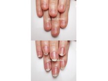 イロ ネイルアトリエ(iRo nail atelier)の雰囲気（【初回オフ込み】深爪矯正クリア☆¥6900）