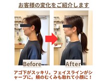 マドカヨガビューティーオフィス(MADOKA YOGA BEAUTY OFFICE)の雰囲気（１回の「整体ストレッチ」で肩こり改善とあご下スッキリ！小顔へ）