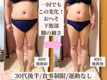 ピーチ(Peach)の雰囲気（【脱ぽっこりお腹】お腹・腰回り集中★骨盤矯正×リンパ×腸もみ）
