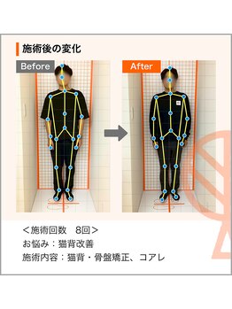 ただき接骨院 整体院 新前橋院/ お悩み：姿勢・猫背改善 