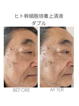 コモア(COMOA)/エイジングケアしませんか？