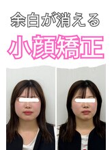ラフテル鍼灸整骨院 小顔矯正 施術例