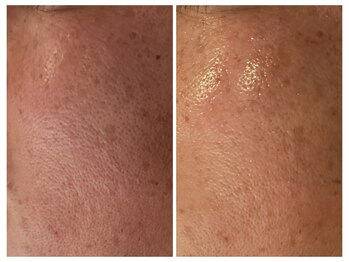 ベリッセ(Belisse)/*贅沢フルコース*