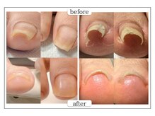 カンパニュラ(Campanula)