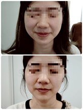 縁(en)/レモンボトル2回