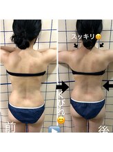 美容カイロ 骨盤矯正 整体 ウェルネス札幌 カイロサロンウェーブ(WAVE)/美容カイロボディケア超スッキリ