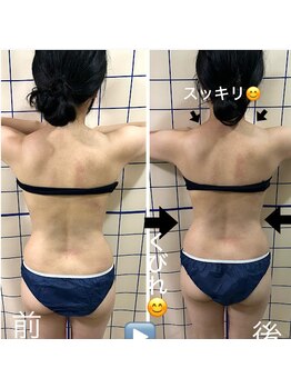 美容カイロ 骨盤矯正 整体 ウェルネス札幌 カイロサロンウェーブ(WAVE)/美容カイロボディケア超スッキリ