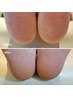 【足元キレイにリセット☆】個室完備♪フットジェルオフ+足裏角質ケア ¥8,500