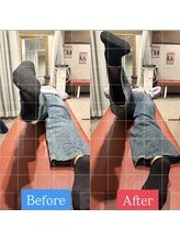 ナオル整体 宮崎院(NAORU整体)/20代女性施術事例【反り腰改善】