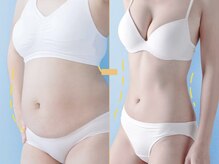 楽だの雰囲気（超痩身／デトックス［ハイパーナイフxシェイプx玉川岩マッ発汗]）