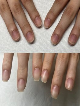 爪の悩みを解消できる（ケア含む）