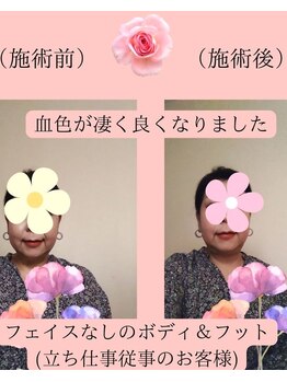 プウセラピー(puu_therapy)/お肌が違うビフォーアフター