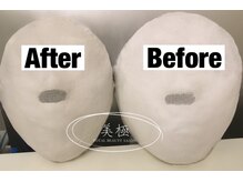 美極 トータルビューティー(美極 TOTAL BEAUTY)/恵比寿/小顔コルギ/エステ/