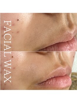 モアナ(Moana)/フェイシャルワックス☆