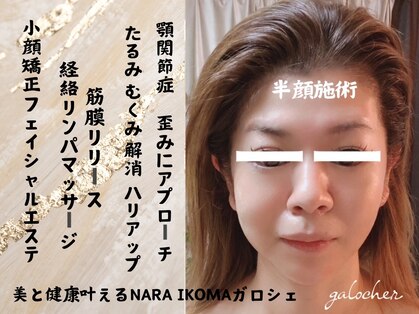 ガロシェ(galocher)の写真